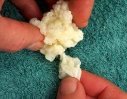 A milk kefir grain with a smaller grain budding from it